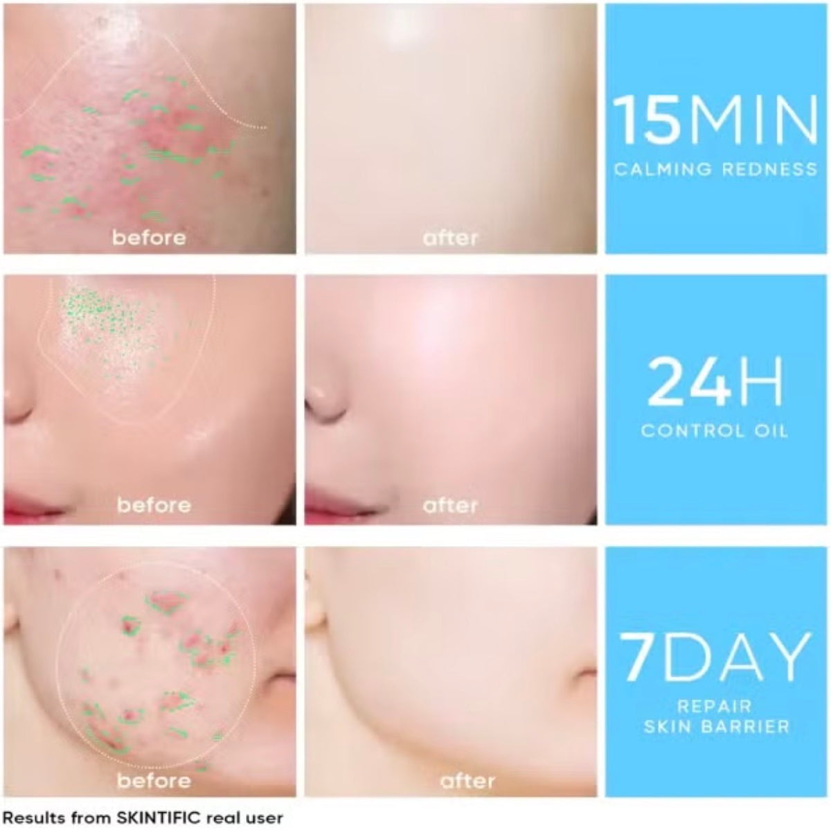 SKINTIFIC 5X Ceramide Barrier Moisture Gel – Light Texture