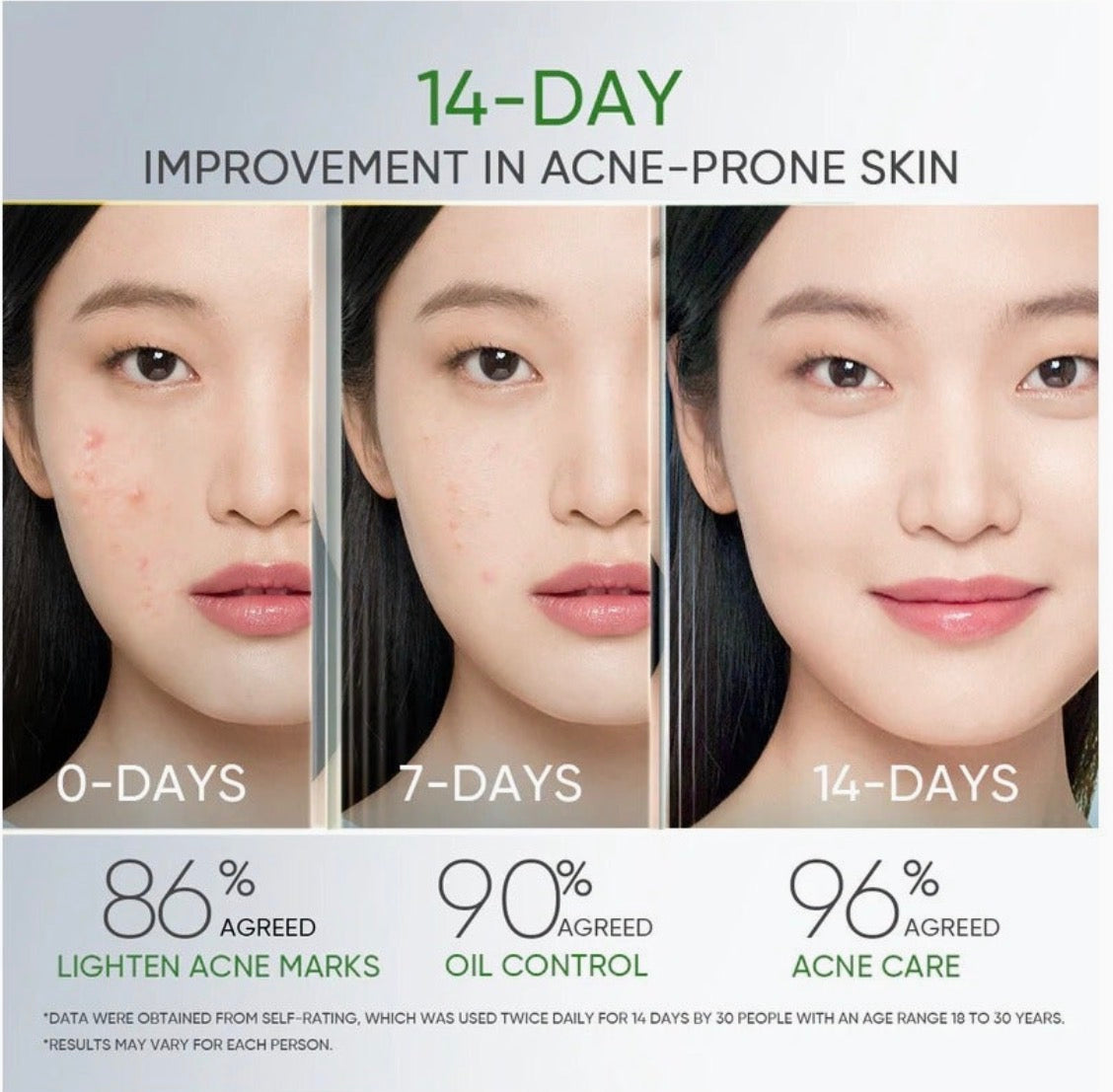 Skintific 3X Acid Anti-Acne Gel Moisturizer